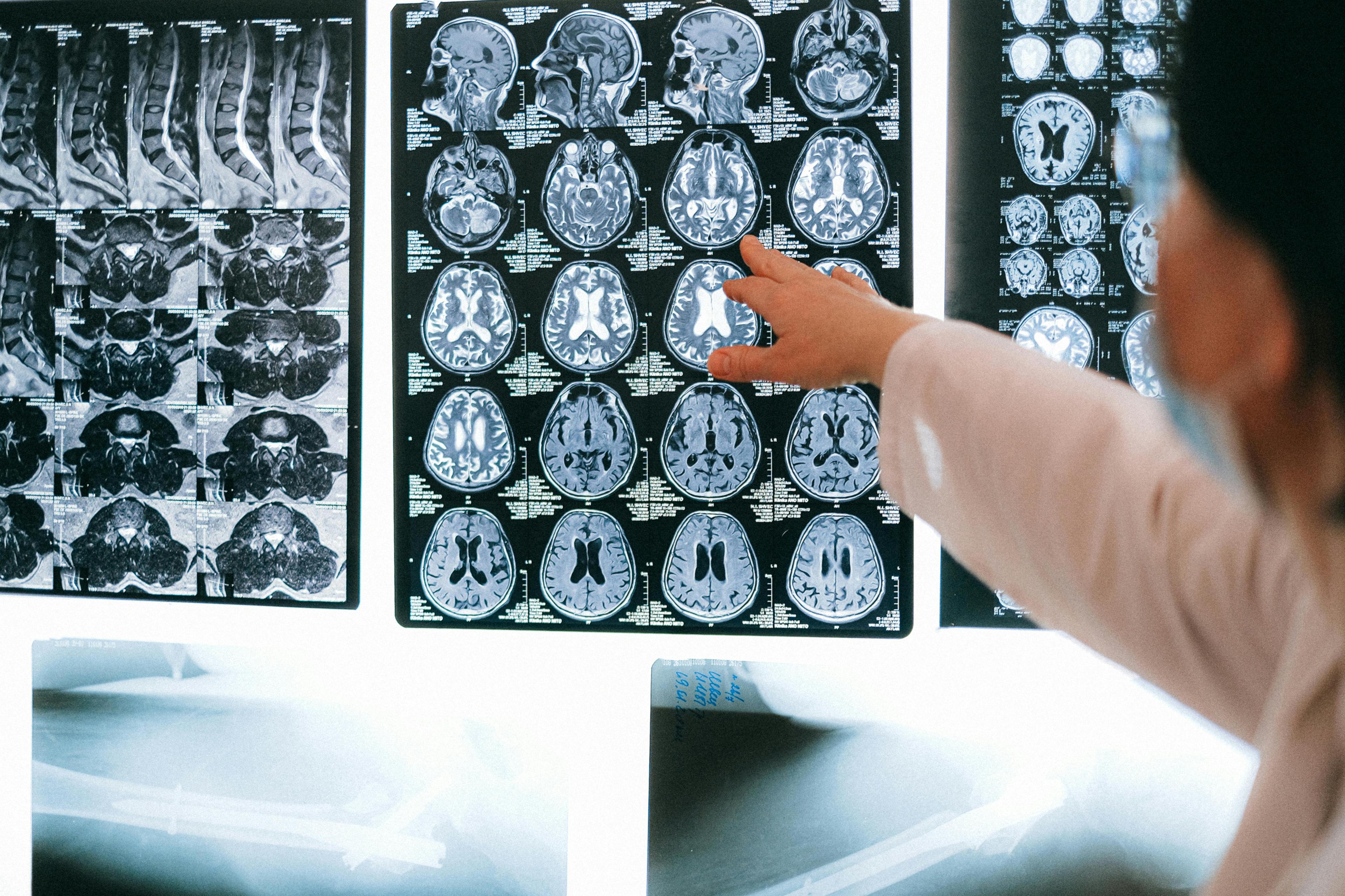 You Are Not a Brain in a Lab